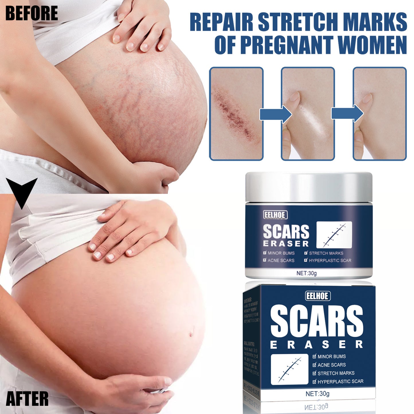 Scar Repair Gel Ointment