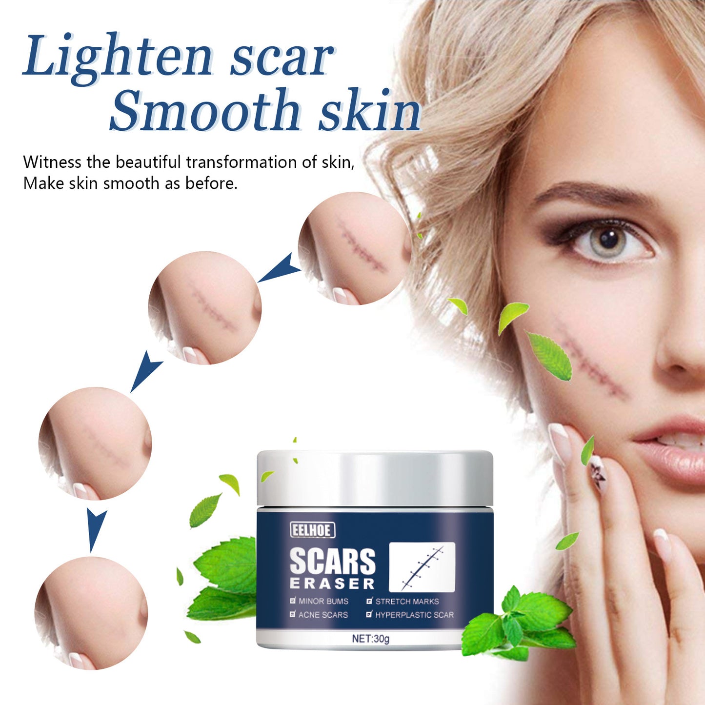 Scar Repair Gel Ointment